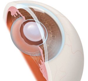 tipuri de cristalin artificial pret