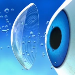 lentile de contact permanente