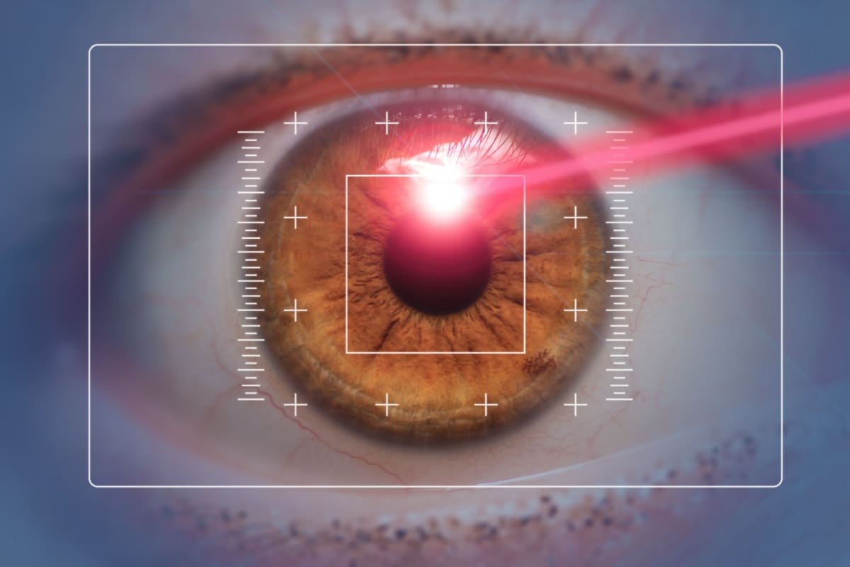 Tratament laser pentru ochi