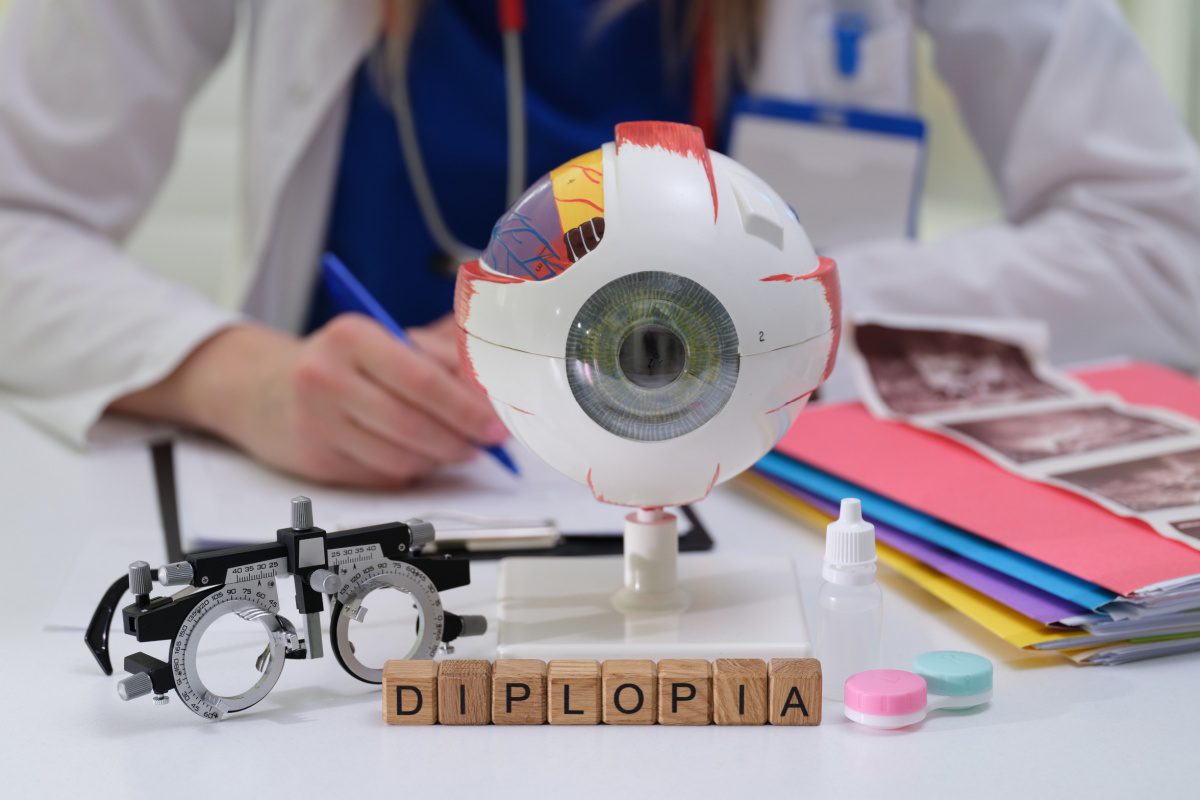  Model ochi si alte echipamente folosite in diagnosticarea si gestionarea vederii duble sau diplopiei
